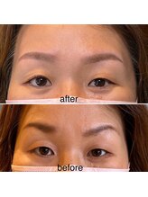 美眉アンド美肌専門サロンすみれ/ビフォーアフター