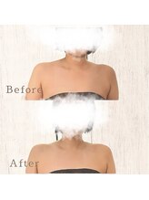 ブリリアントライフ(Blilyant life)/1発で華奢見え！