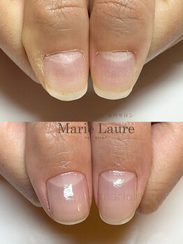 マリーロール 淀屋橋本店(Marie Laure)/自爪育成/深爪矯正/ネイルケア