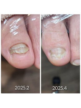 爪切り屋 足楽/