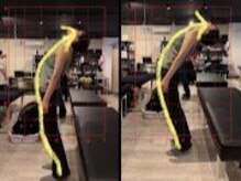 ビーワイ鍼灸整骨院 心斎橋院/before&after