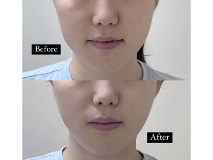 ルブランビューティー 麻布十番(Le blanc beauty)の写真