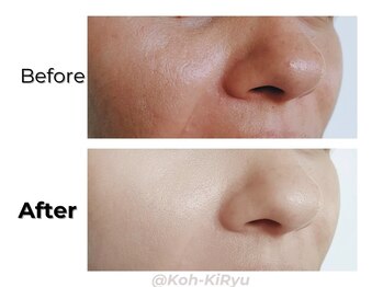 香嬉琉/Before&After［コースのお客様］