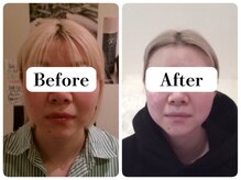 マンマ ジュンナ/【浜松/小顔/小顔矯正】