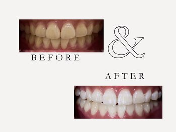 ホワイト つくば店(WHITE)/症例写真