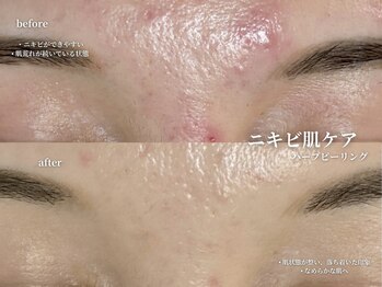 コウル 川西能勢口店(geoul)/透明感アップコース3回