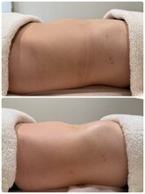 ピュウリリアーナ(Piu liliana)/