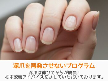 レアム/再発させない深爪矯正。