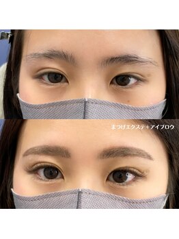 アイル(I'll)/お目元の印象がこんなに変わる！