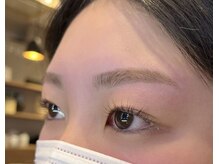 美眉アンド美肌専門サロンすみれ/ビフォーアフター