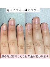 桃の木 吉祥寺店/爪を整えるだけで印象変わります