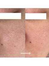 シェノン 赤坂大濠店/