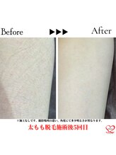 オリオンドットエスツー(Orion.S2)/【Before→After】