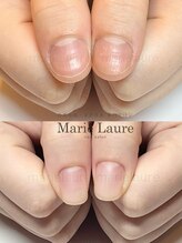 マリーロール 梅田店(Marie Laure)/深爪矯正/自爪育成/自爪風