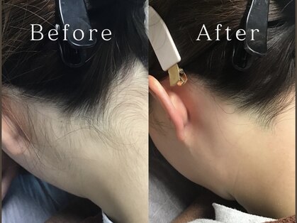 スキンリープワックスサロン 川崎店(SKINLEAP Wax salon)の写真