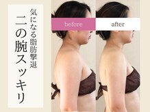 ティアラの雰囲気（21時まで受付OK！！仕事帰りにもぴったり[月島/豊洲/小顔矯正]）