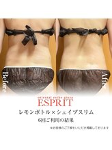 エスプリ 銀座店/レモンボトル×シェイプスリム