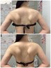 【即効＆痛みが少ない】REVIハーブピーリング+肩甲骨はがし90分