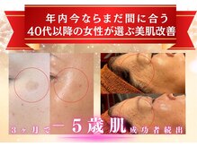 エム 佐賀江北店(EMU)