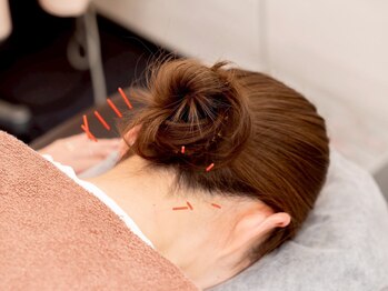 横浜杉田鍼灸院 深部整体院/肩こり・腰痛・身体のだるさetc