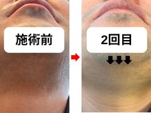 米子エイト/30代