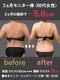 蓮子の夢の写真/最新機器で背中・二の腕をスリムに！二の腕や背中のはみ肉スッキリを目指す！