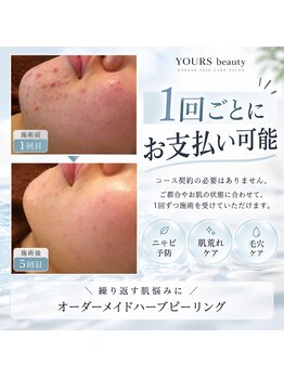 ユアーズ ビューティー(YOURS beauty)の写真/まずはお試し価格の体験が魅力。毛穴やニキビに寄り添うサロンで美を磨く一時を♪