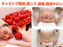 カエツ 銀座店(Kaetsu)の雰囲気（カッピングは 血流を促し、冷えやコリの改善に◎痩身効果すごい）