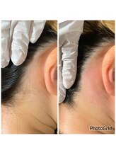 マイレ 銀座(MAILE)/うなじ