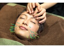 ビーカラット(B/CARAT)/【Ｂ/CARAT式美容鍼・美顔鍼】