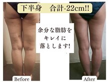 ヨサパーク アーバンヘブン 目黒(YOSA PARK Urban Heaven)/効果をしっかり感じられる！