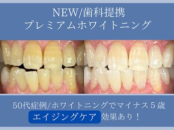 ホワイトニングカフェ 平塚店(WhiteningCafe)/◎歯のホワイトニング施術写真◎