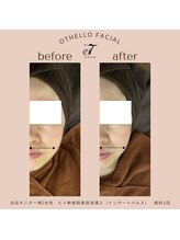 ナナ(nana)/◆before/after◆