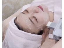 ディオーネ 岡崎店(Dione)の雰囲気（人気No.1美顔脱毛☆コラーゲン生成でモチモチプルプルに♪）