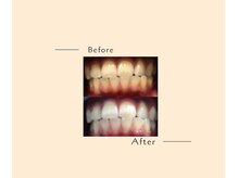 オベリオ(OBERIO)/