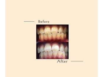 オベリオ(OBERIO)/