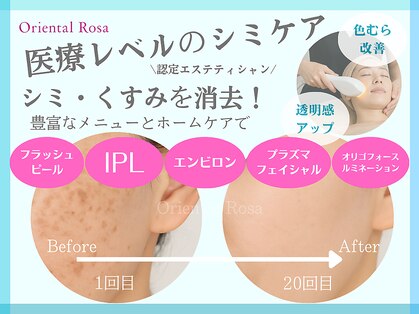 オリエンタルローザ 表参道(Oriental Rosa)の写真
