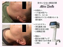ソワン ド ブランシュ ライフ八戸ノ里店(Soin de Blanche)の雰囲気（東大阪初！ミコステラで美肌育成　小顔/シミ/眉毛/マツエク]）