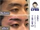 ヒゲ革命 難波日本橋の写真