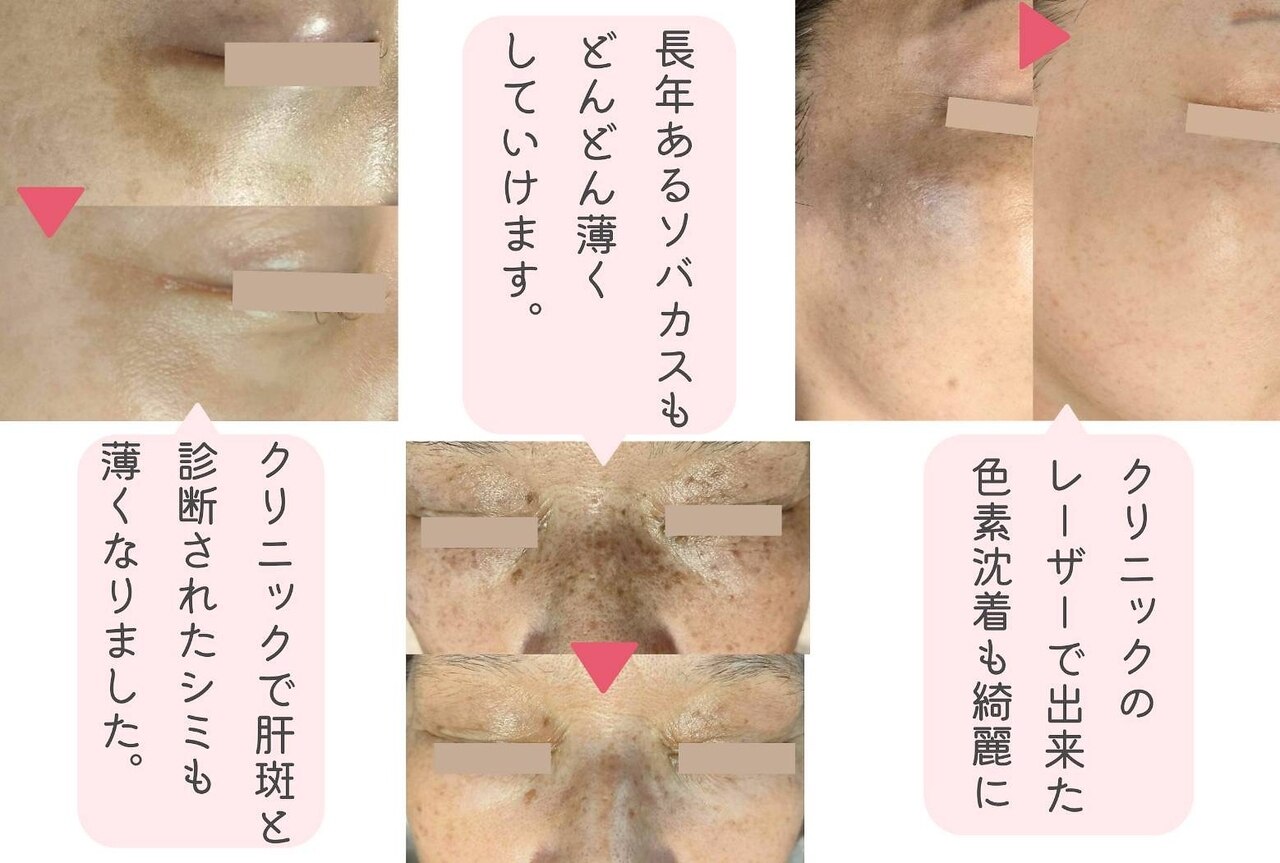 モモイロ(momoiro)｜ホットペッパービューティー