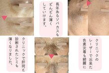 モモイロ(momoiro)