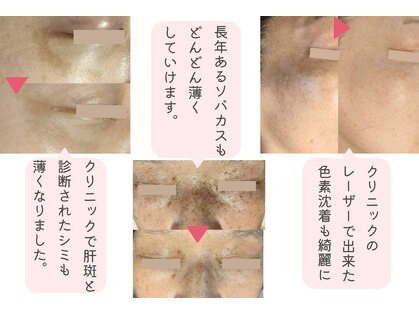 モモイロ(momoiro)の写真