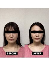 美骨ラボ 自由が丘(美骨Labo)/施術before＆after