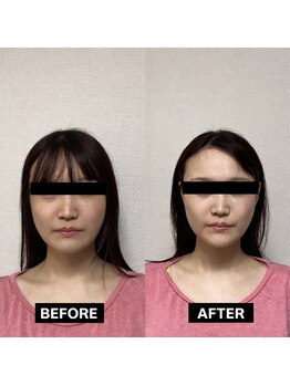 美骨ラボ 自由が丘(美骨Labo)/施術before&after