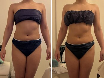 ナースのロミリンパ/