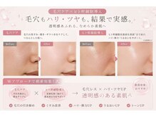 イトウサロン(ITO SALON)の雰囲気（毛穴洗浄×ヒト幹導入で、透明感あふれるハリツヤ肌へ♪）