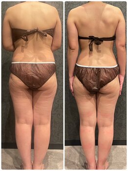 ソルエユニーク(Le seul et unique)/マッサージに遠赤外線マットで！