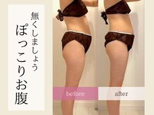 ティアラの雰囲気（食事や美容に関することもご質問承ります◎[痩身/ダイエット]）