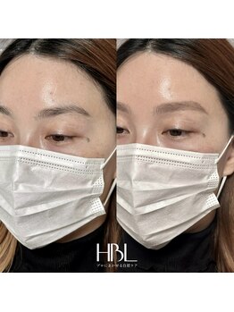 ミィ(mi)/ハリウッドブロウリフト