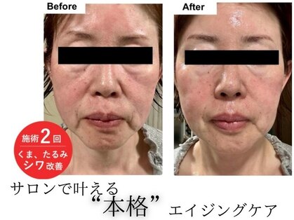 パタティパタタ(PatatiPatata)の写真